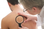 Câncer de pele: conheça os três principais tipos